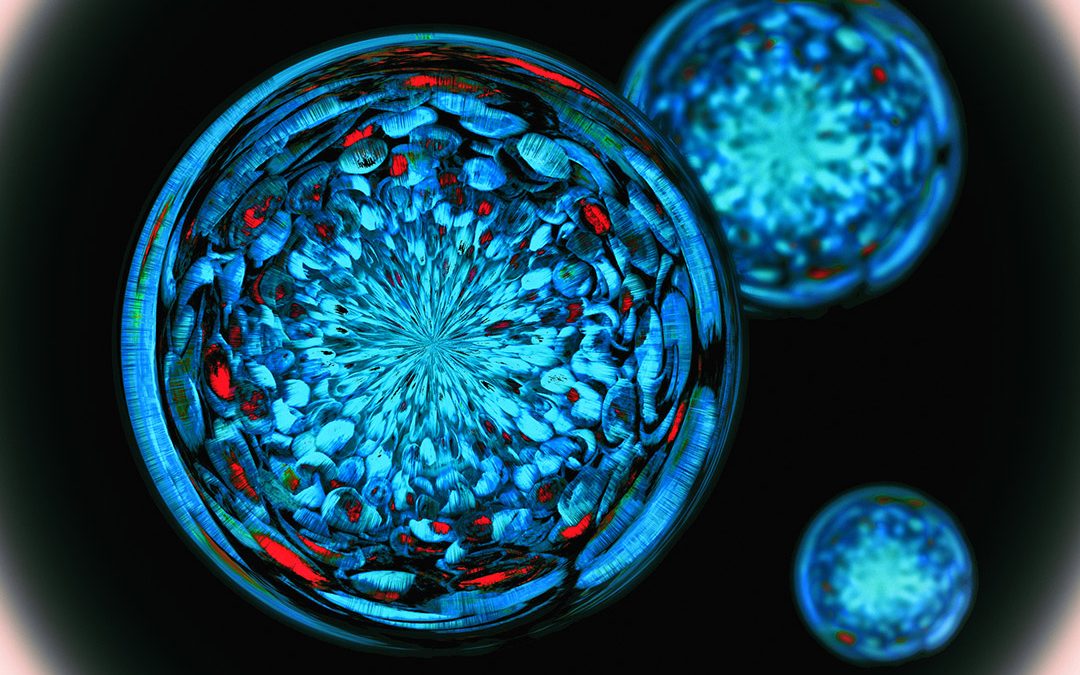 Autoimmune Diseases & Diet